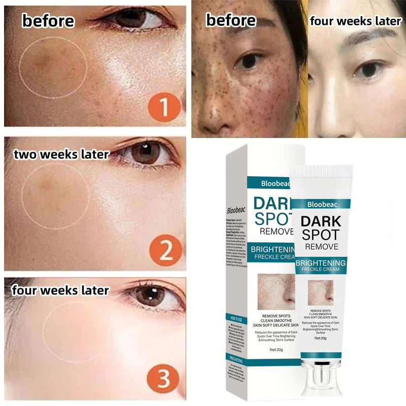 【Official Store】Natural Blemish Removing Beauty Cream – Fades Dark Spots, Freckles & Wrinkles | Age-Defying, Even-Tone Treatment