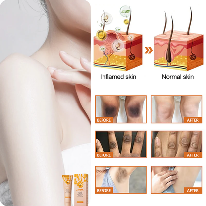 NESLEMY™ Purifying Exfoliating Gel for Acanthosis Nigricans, Exfoliation, Dark Spots, Skin Tags, and Eczema