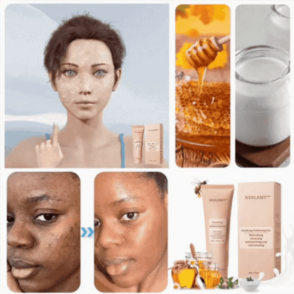 NESLEMY™ Purifying Exfoliating Gel for Acanthosis Nigricans, Exfoliation, Dark Spots, Skin Tags, and Eczema