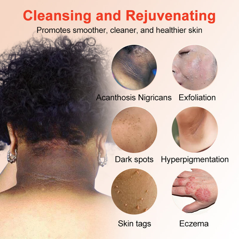 NESLEMY™ Purifying Exfoliating Gel for Acanthosis Nigricans, Exfoliation, Dark Spots, Skin Tags, and Eczema
