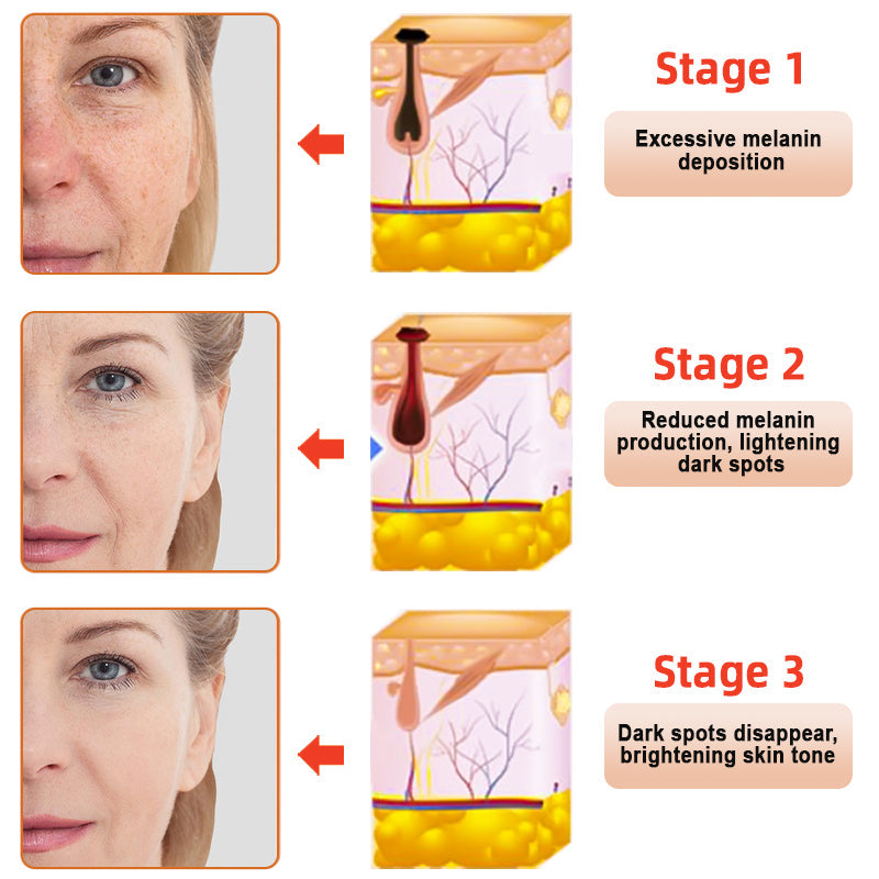 NESLEMY™ Purifying Exfoliating Gel for Acanthosis Nigricans, Exfoliation, Dark Spots, Skin Tags, and Eczema