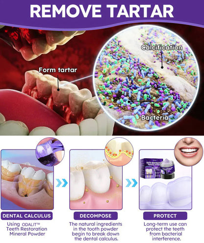 🌿Flash Sale - ODALIT™ Teeth Restoration Mineral Powder🦷(ADA recommended)👩‍⚕️(Treats periodontitis and mouth ulcers, prevents tooth loss, and repairs gum recession)
