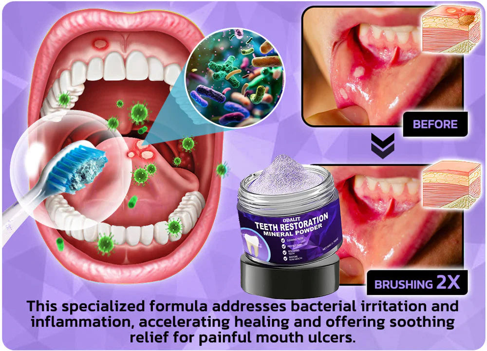 🌿Flash Sale - ODALIT™ Teeth Restoration Mineral Powder🦷(ADA recommended)👩‍⚕️(Treats periodontitis and mouth ulcers, prevents tooth loss, and repairs gum recession)